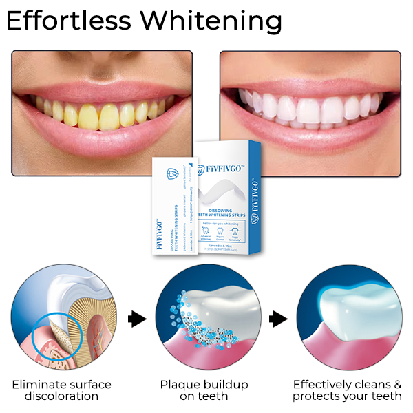 Fivfivgo™ Dissolving Teeth Whitening Strips
