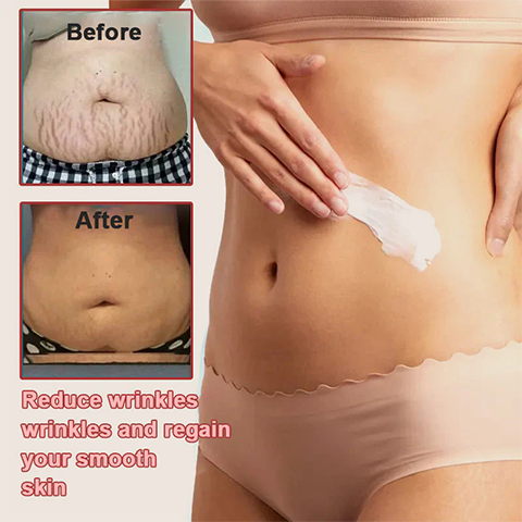 Fivfivgo™ Firming Blemish Rejuvenating Cream