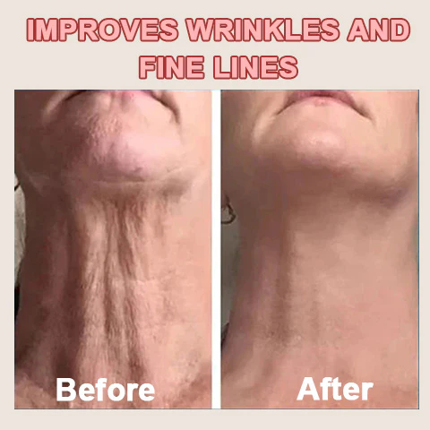 Fivfivgo™ Firming Blemish Rejuvenating Cream