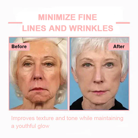 Fivfivgo™ Firming Blemish Rejuvenating Cream