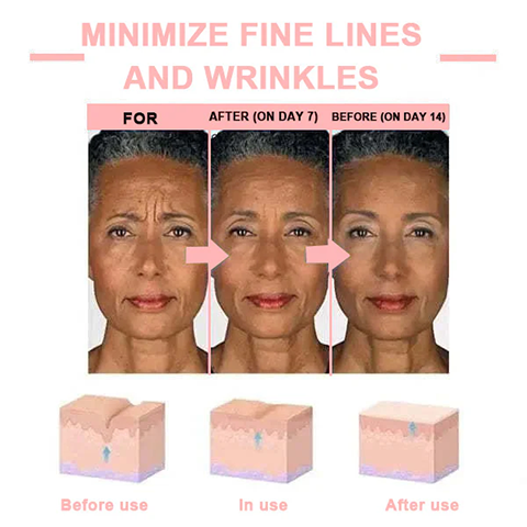 Fivfivgo™ Firming Blemish Rejuvenating Cream