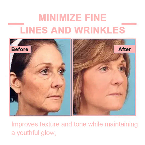 Fivfivgo™ Firming Blemish Rejuvenating Cream
