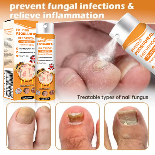 Fivfivgo™ PsoriaHeal Bee Venom Psoriasis Treatment Spray(Suitable for all skin conditions)