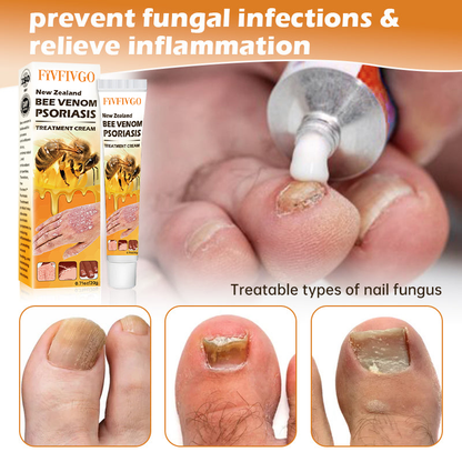 Fivfivgo™ New Zealand Bee Venom Psoriasis Treatment Cream