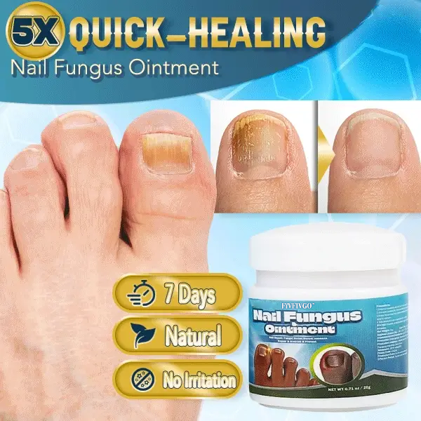 Fivfivgo™ 5X Quick-healing Nail Fungus Ointment