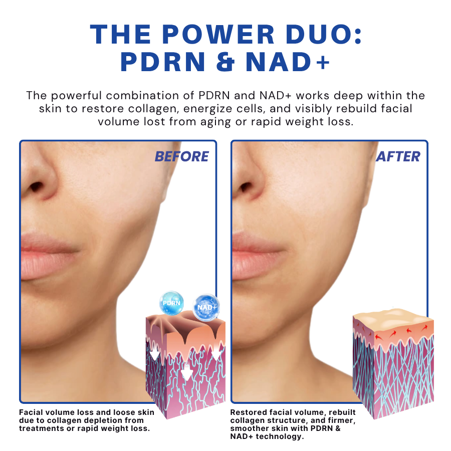 Fivfivgo® PDRN-NAD+ Cica Reedle Shot Serum 16 Fivfivgo® PDRN-NAD+ Cica Reedle Shot Serum