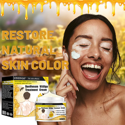 Fivfivgo™ Bee Venom Vitiligo Treatment Cream