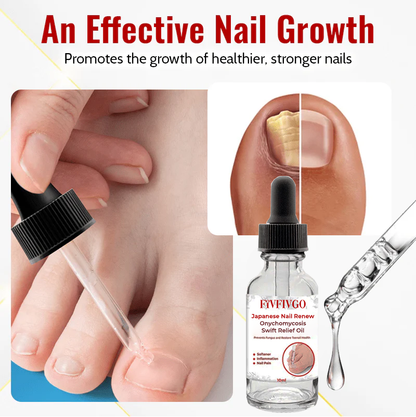 Fivfivgo™ Japanese Nail Renew Onychomycosis Swift Relief Oil