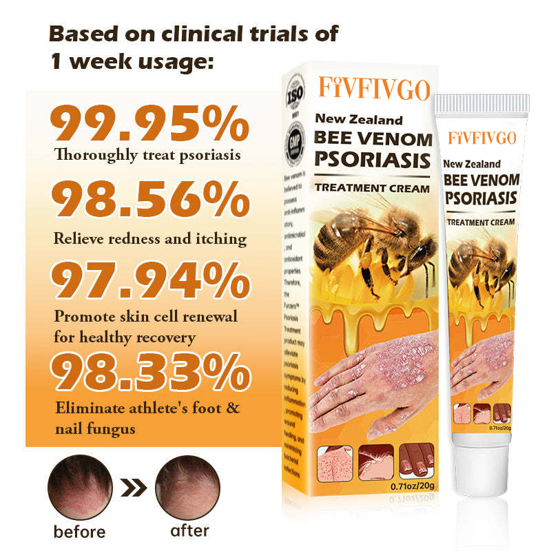 Fivfivgo™ New Zealand Bee Venom Psoriasis Treatment Cream