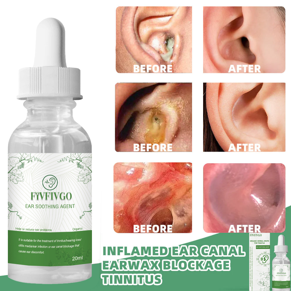 Fivfivgo™ Organic Herbal Drops for Tinnitus