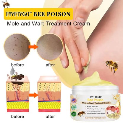 Fivfivgo™ Bee Poison Mole and Wart Treatment Cream