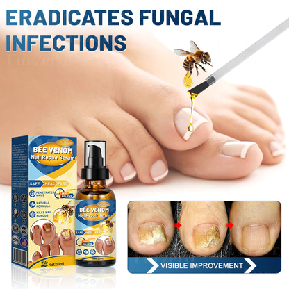 Fivfivgo™ Bee Venom Nail Repair Serum (Dermatologist Tested)