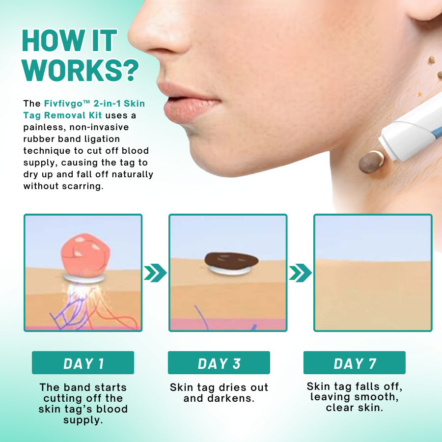 Fivfivgo™ 2-in1 Skin Tag Removal Kit