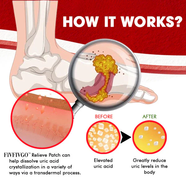 Fivfivgo™ Gout Relieve Patch