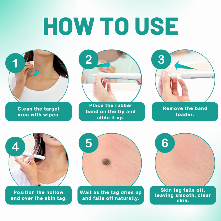 Fivfivgo™ 2-in1 Skin Tag Removal Kit