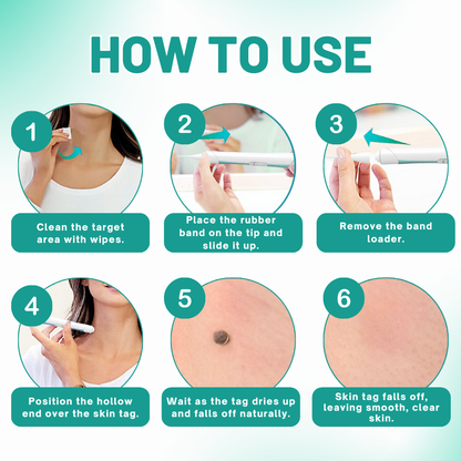 Fivfivgo™ 2-in1 Skin Tag Removal Kit