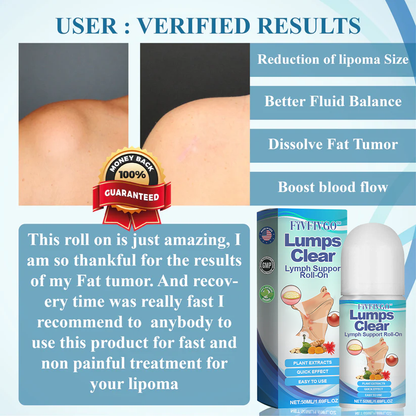 Fivfivgo™ LumpsClear Lymph Support Roll-On