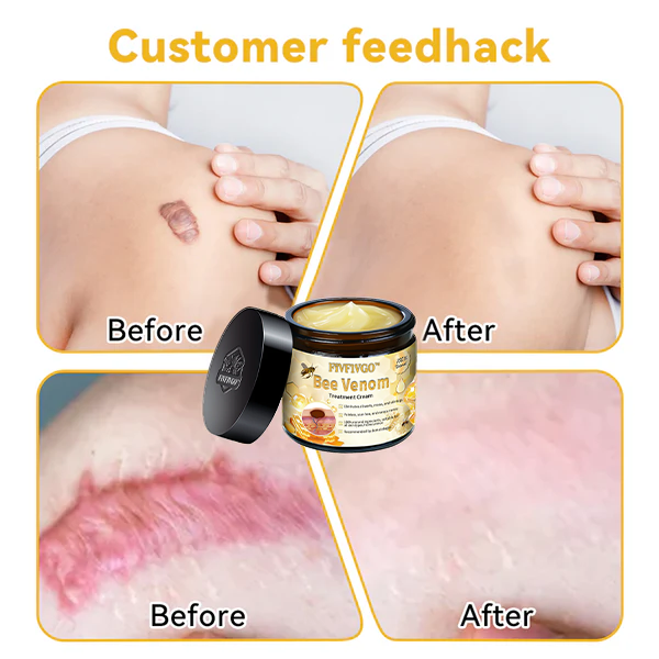 Fivfivgo™ Bee Venom Skin Treatment Cream