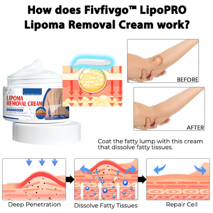 Fivfivgo™ LipoPRO Lipoma Removal Cream