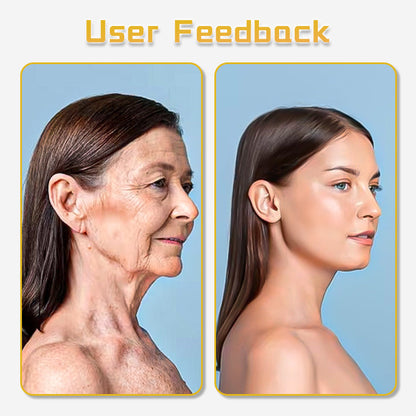 Fivfivgo™ Ultrasonic Facelift Device