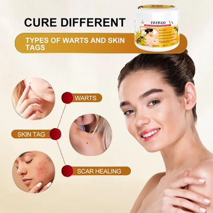 Fivfivgo™ Bee Venom Mole and Wart Treatment Cream