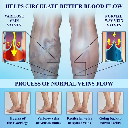 Fivfivgo™ Vein Support UltrasonicBand