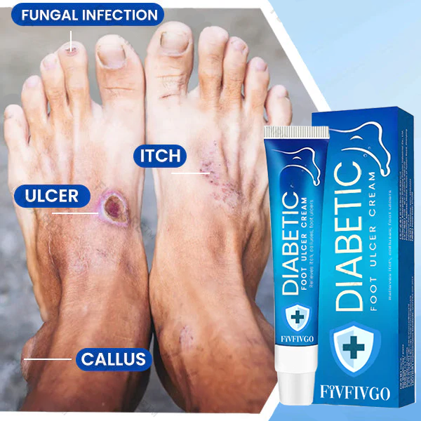 Fivfivgo™ Diabetic Foot Ulcer Cream