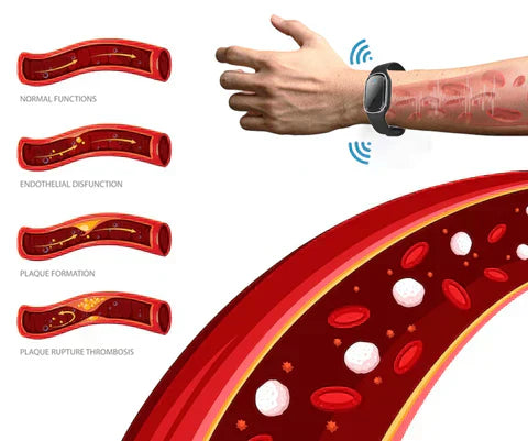 Fivfivgo™ Ultrasonic Fat Burning and Detoxification Bracelet