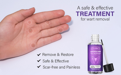 Fivfivgo™ AraneaCare Skin Tag Remover