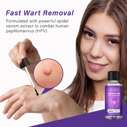 Fivfivgo™ AraneaCare Skin Tag Remover