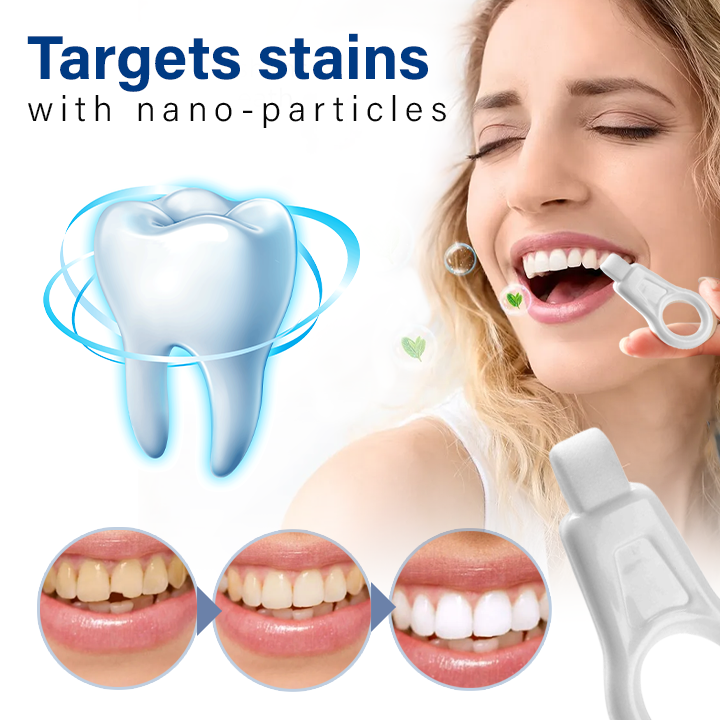 Fivfivgo™ NanoShine Tooth Stain Cleaner