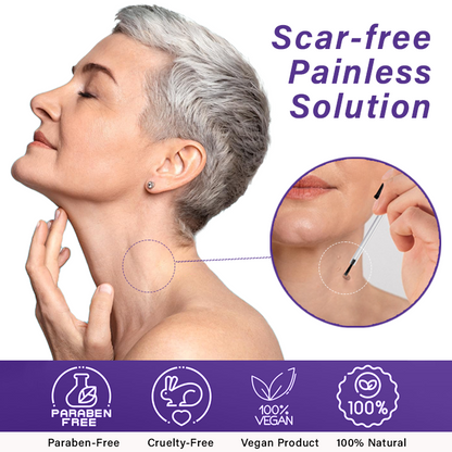 Fivfivgo™ AraneaCare Skin Tag Remover