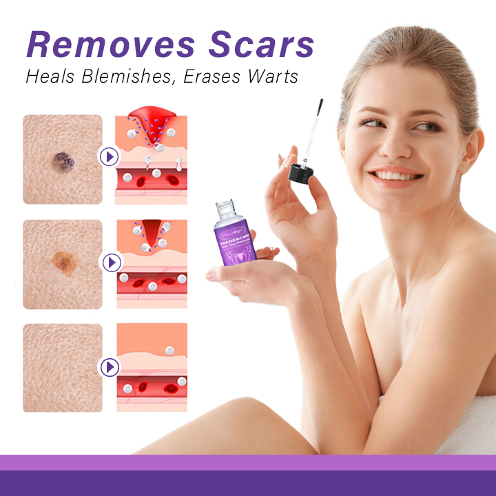 Fivfivgo™ AraneaCare Skin Tag Remover