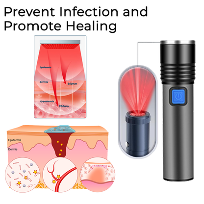 Fivfivgo™ Wound & Ulcer Healing Infrared Pen