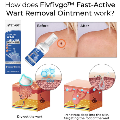 Fivfivgo™ Fast-Active Wart Removal Ointment