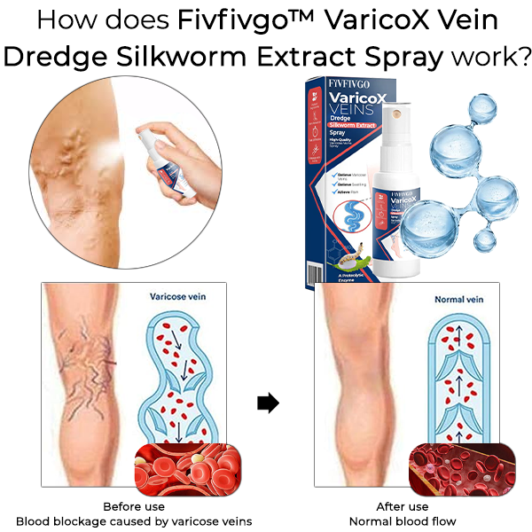 Fivfivgo™ VaricoX Vein Dredge Silkworm Extract Spray