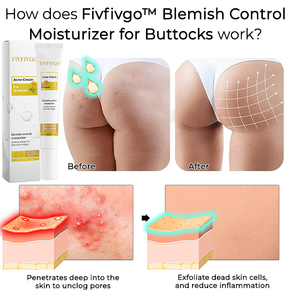 Fivfivgo™ Blemish Control Moisturizer for Buttocks