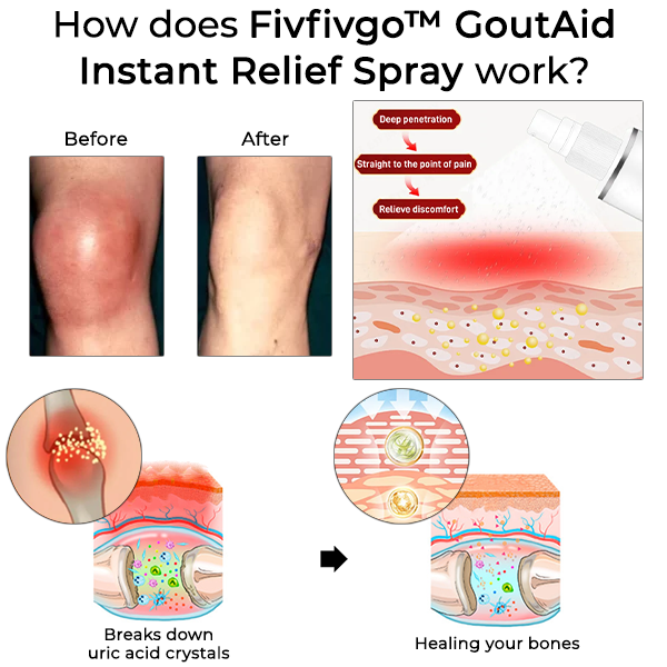 Fivfivgo™ GoutAid Instant Relief Spray