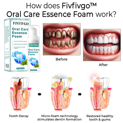 Fivfivgo™ Oral Care Essence Foam