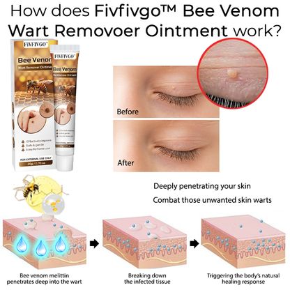 Fivfivgo™ Bee Venom Wart Remover Ointment