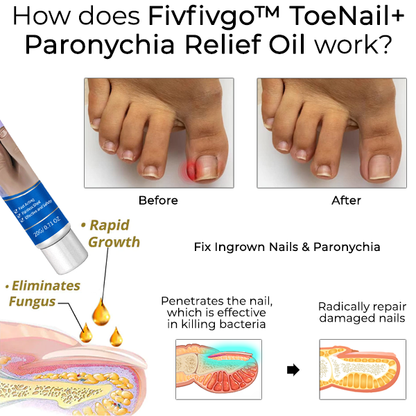 Fivfivgo™ ToeNail+ Paronychia Relief Oil