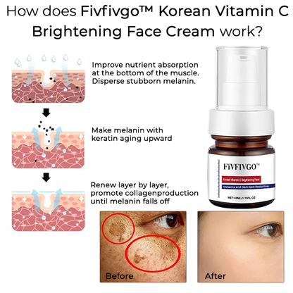 Fivfivgo™ Korean Vitamin C Brightening Face Cream for Melasma and Dark Spot Reduction