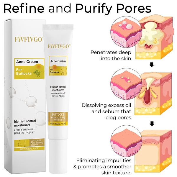 Fivfivgo™ Blemish Control Moisturizer for Buttocks