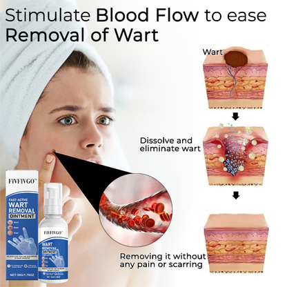 Fivfivgo™ Fast-Active Wart Removal Ointment