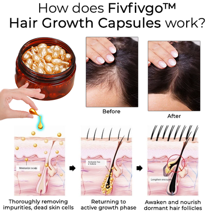 Fivfivgo™ Hair Growth Capsules