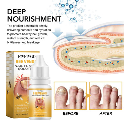 Fivfivgo™ BeeVenom Nail Fungus Solution