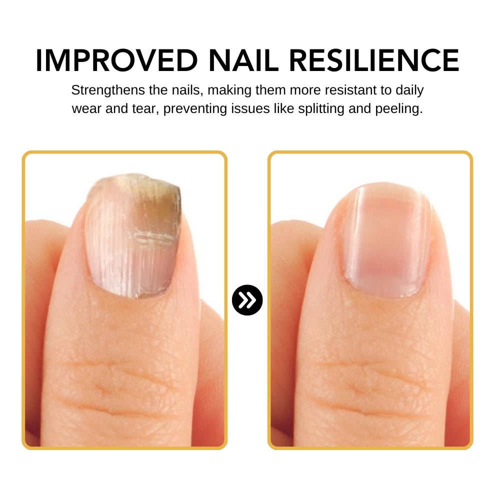 Fivfivgo™ BeeVenom Nail Fungus Solution