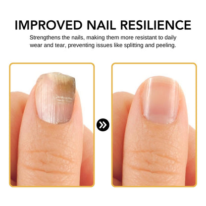 Fivfivgo™ BeeVenom Nail Fungus Solution