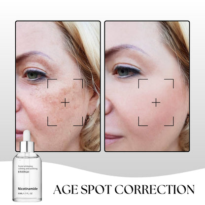 Fivfivgo™ Botox Anti-Aging Serum