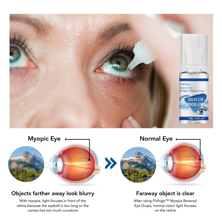 Fivfivgo™ Myopia Reversal Eye Drops – bodiluvs.com